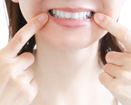 歯をできるだけ削らない審美治療という選択肢