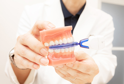 SMAとはどのような矯正治療ですか？