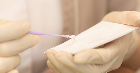 ラミネートベニアとはどのような治療ですか？