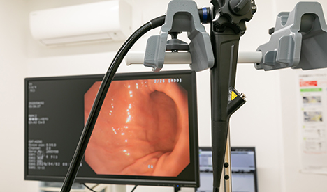 胃がんのリスクはどのように決まりますか？